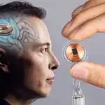 MUSK NEURALINK