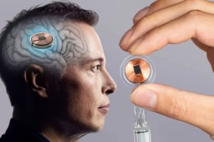 MUSK NEURALINK