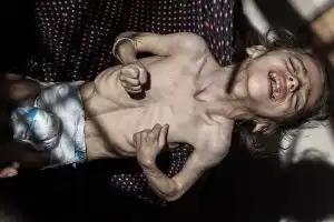 GAZA IN FAMINE
