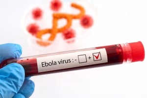 Nigeria Confirms First Ebola Case Amid African Outbreak