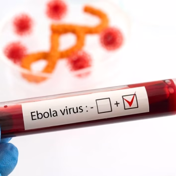 Nigeria reports first Ebola case-IAN