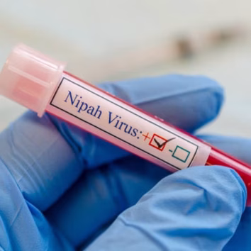 A tube contain fictitious Nipah virus contain blood